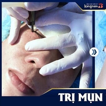 C&aacute;ch trị Mụn thịt