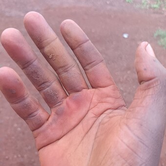 kgothatsomeltonkobola@gmail.com