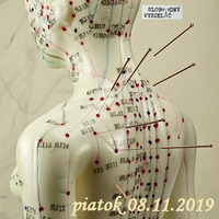 Riešenia a alternatívy 136 - 2019-11-08 Akupunktúra by Slobodný Vysielač