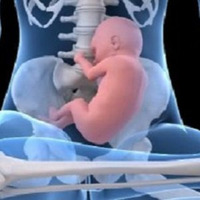 Sám sebe lekárom 6 - 2015-05-12 Ako sa rodia Husákovi vnuci (o slovenskom pôrodníctve) by Slobodný Vysielač