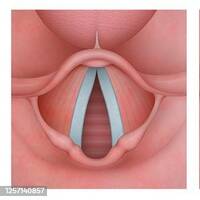 Hors Format - La VoiX, c'est quoi ? by Radio Albigés