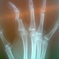 Junior Santiago - Half Broken Finger Session by DJ Junior Santiago