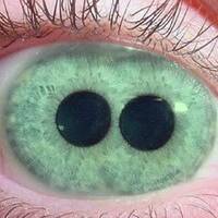 Mutantenstadl by Neuronenrestaurator