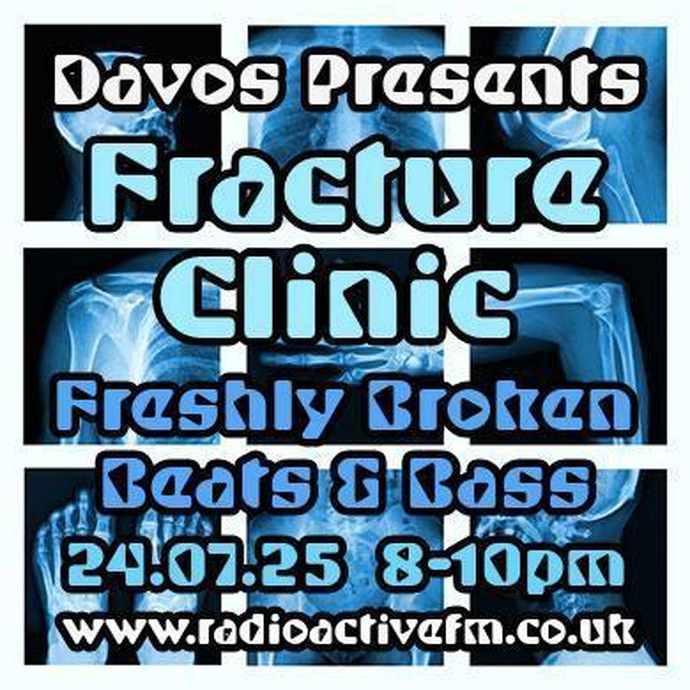 Davos Live - Fracture Clinic - Breaks and Bass 24/07/25 episode artwork