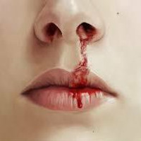 Bleeding Nose - BleedingFingersContest by Madmanmike