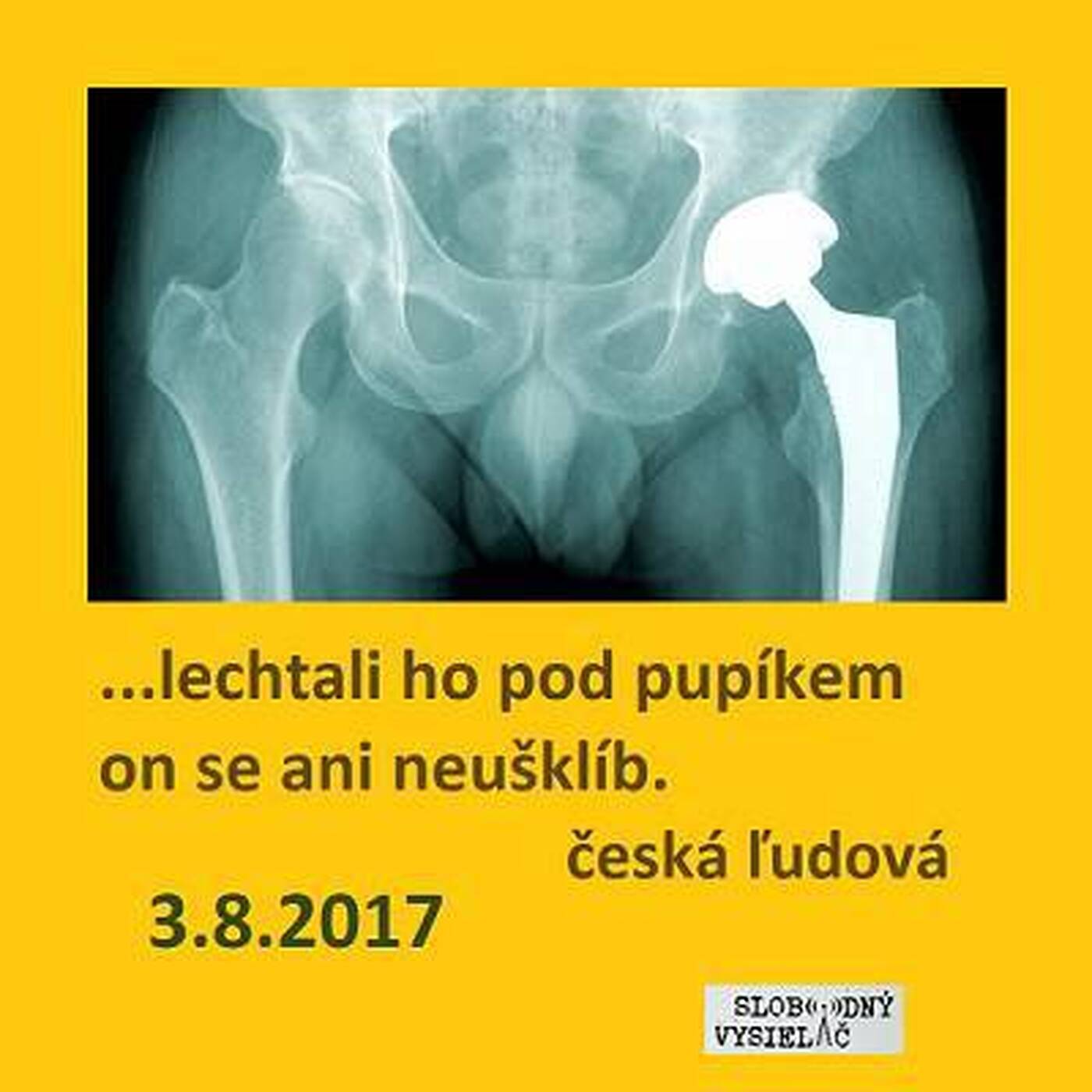 Opony 180 - 2017-08-03 Totálna endoprotéza a iné episode artwork