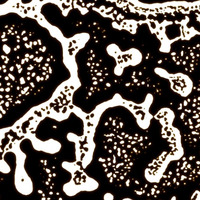 Blofeld's Venom - Pollen (Fexofenadine Hydrochloride Demo) by Blofeld's Venom