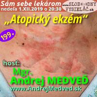 Sám sebe lekárom 199 - 2019-12-01 „Atopický ekzém“ by Slobodný Vysielač