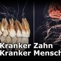 Kranker Zahn - Kranker Mensch_ Im Gespräch mit Vera Wagner by NuoFlix