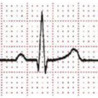Echoes at 60bpm by Lowdjo