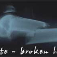 audite - broken legs (Different / Breaks / 2007) by audite